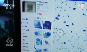 焦点访谈丨辅助诊断、AI问答、健康管理……AI正重塑医疗服务链条